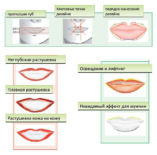 Коррекция губ нитями схема